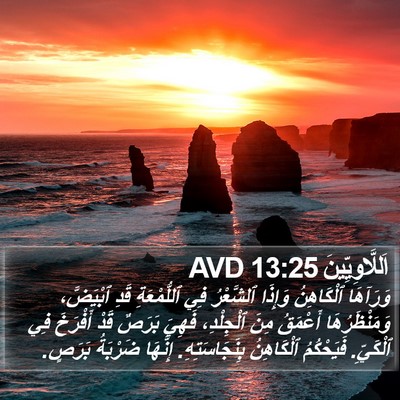 اَللَّاوِيِّينَ 13:25 AVD Bible Verse Image