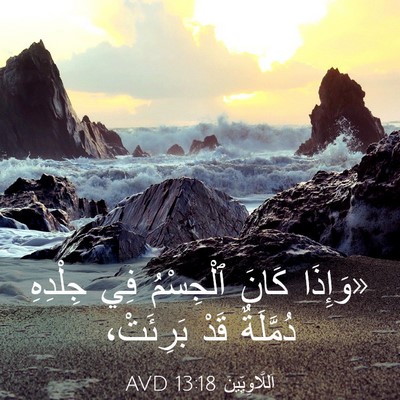 Picture 03 - اَللَّاوِيِّينَ 13:18 AVD - «وَإِذَا كَانَ ٱلْجِسْمُ - Bible Verse Picture
