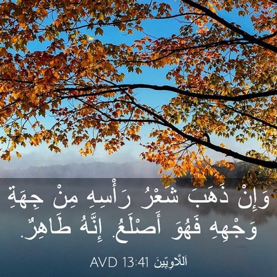 Picture 03 - اَللَّاوِيِّينَ 13:41 AVD - وَإِنْ ذَهَبَ شَعْرُ - Bible Verse Picture