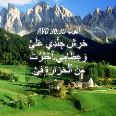 Picture 04 - أَيُّوبَ 30:30 AVD - حَرِشَ جِلْدِي عَلَيَّ - Bible Verse Picture