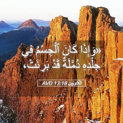 Picture 05 - اَللَّاوِيِّينَ 13:18 AVD - «وَإِذَا كَانَ ٱلْجِسْمُ - Bible Verse Picture