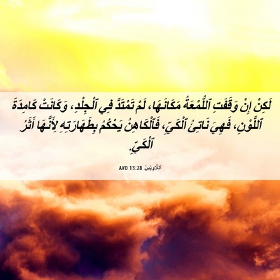 Picture 06 - اَللَّاوِيِّينَ 13:28 AVD - لَكِنْ إِنْ وَقَفَتِ - Bible Verse Picture